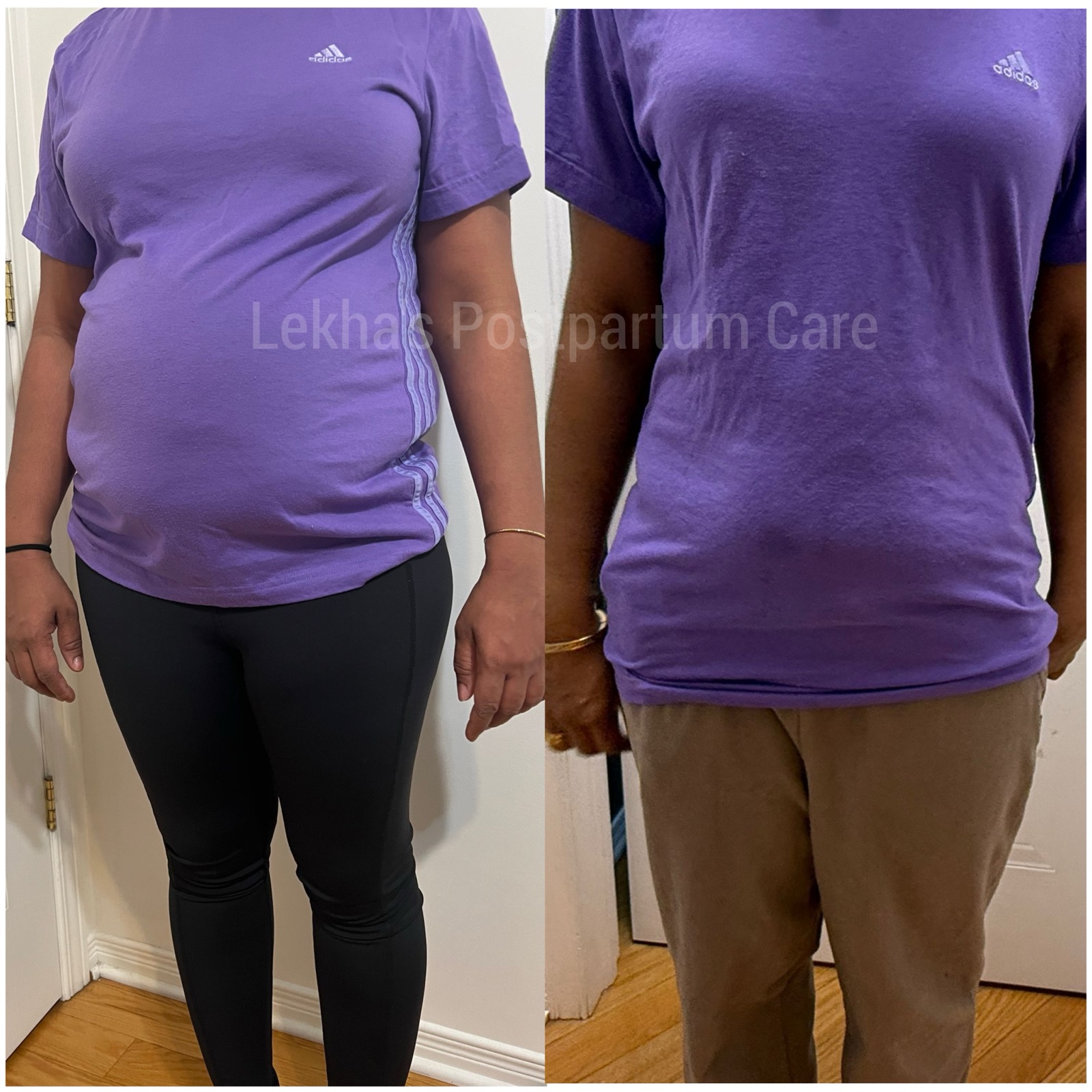 Postpartum recovery before and after care progress