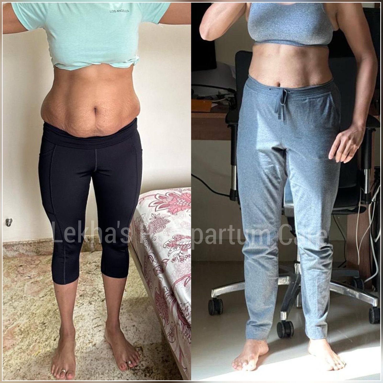Postnatal progress photo from Lekha's postpartum care