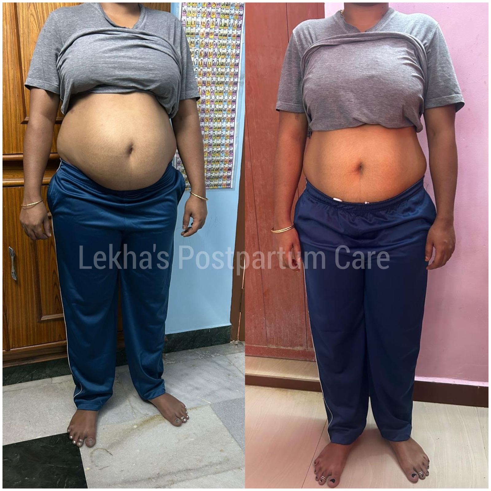 Visible postpartum recovery change before and after
