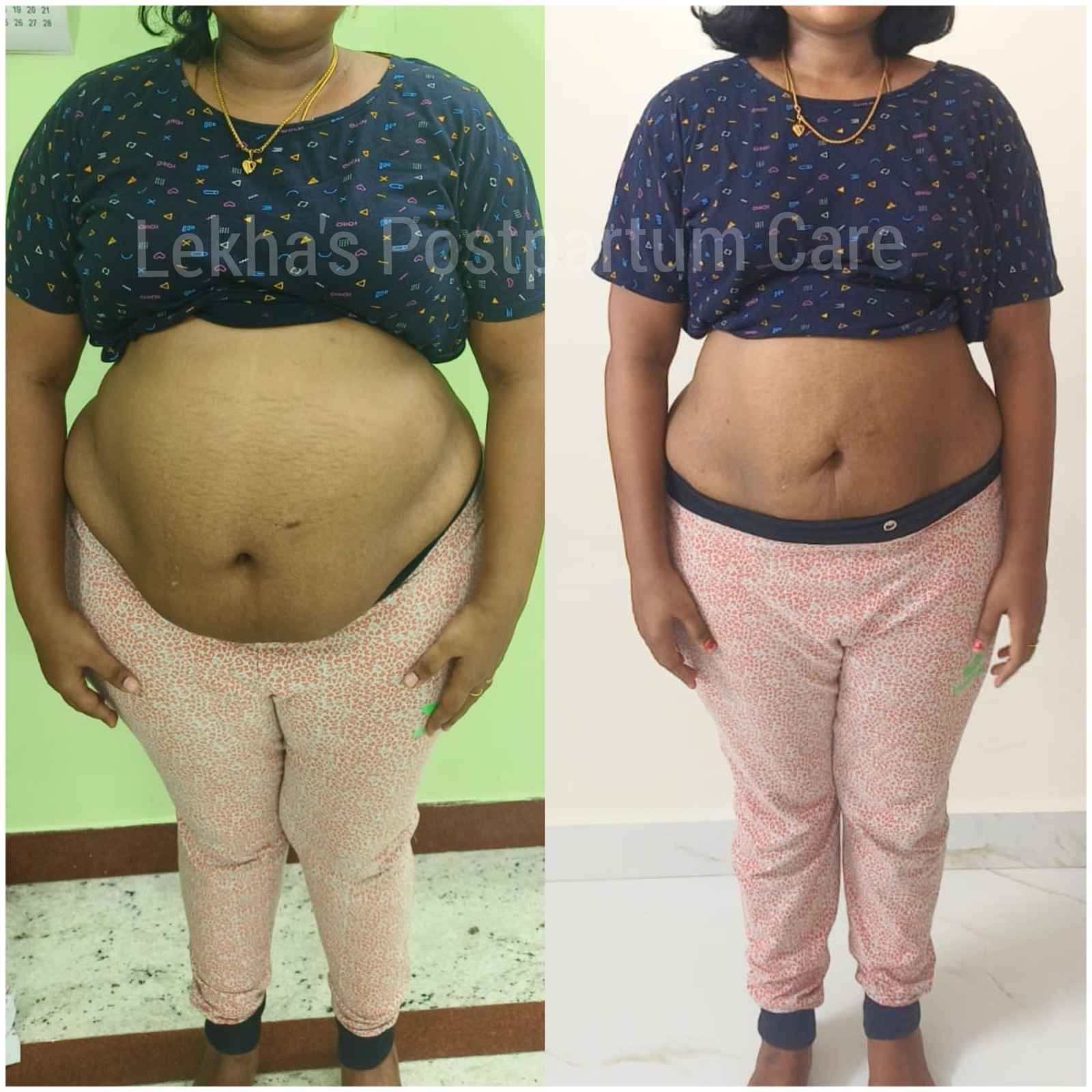 Continued postpartum care follow-up progress